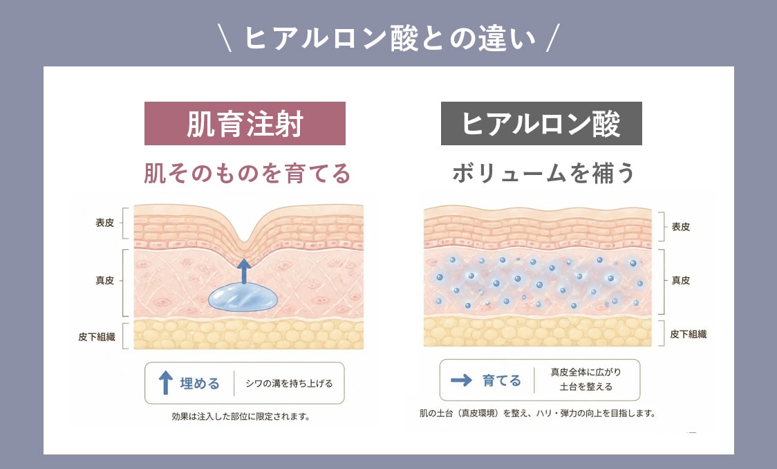 従来のヒアルロン酸注入との決定的な違い