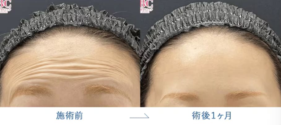 額