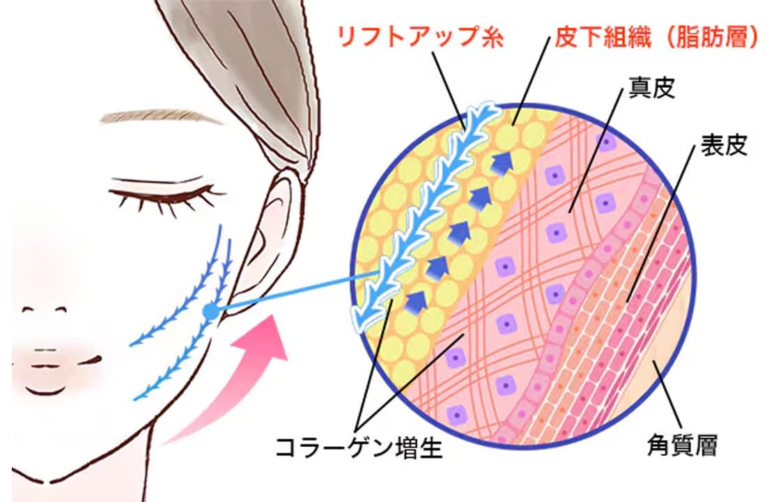仕組みと人気の理由