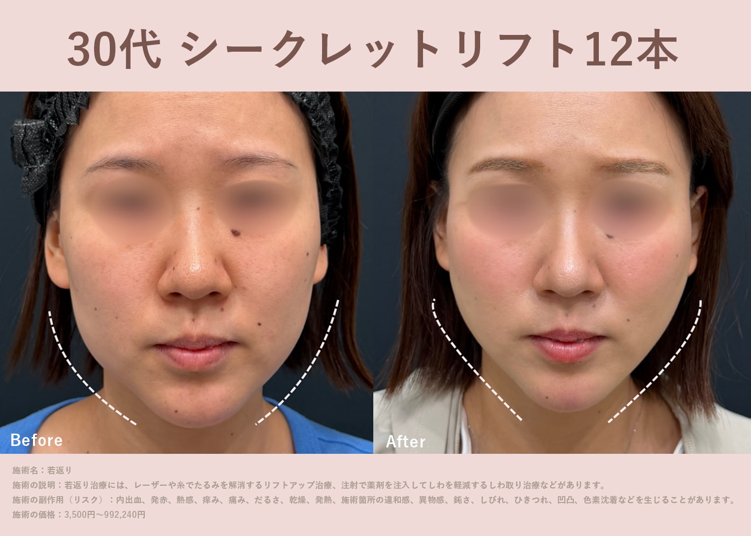 症例写真をご紹介