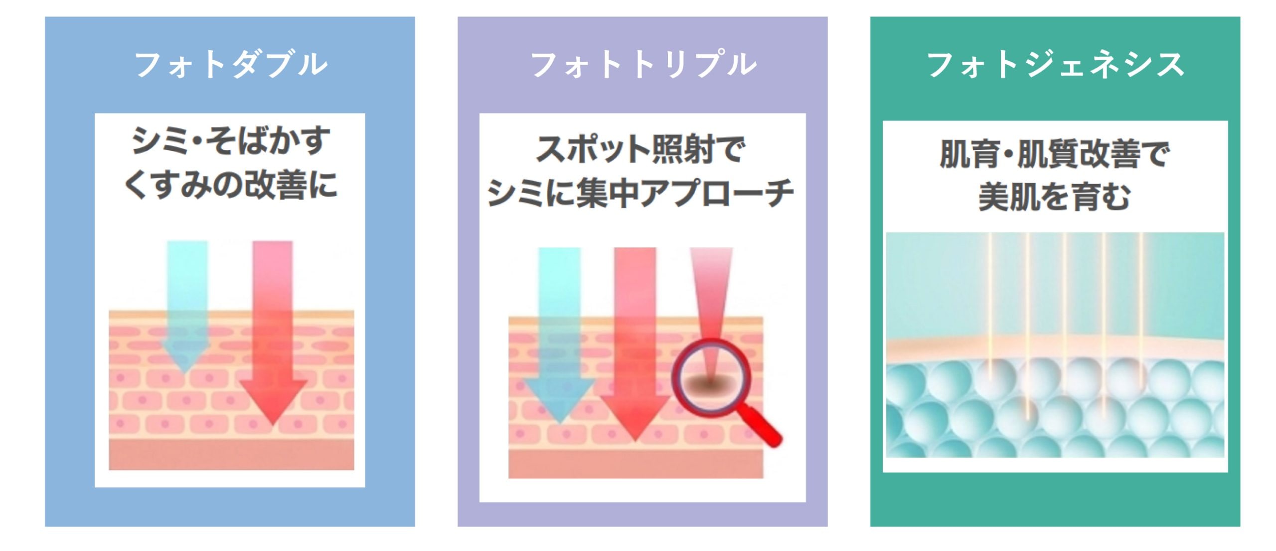 自分に合うのはどれ？