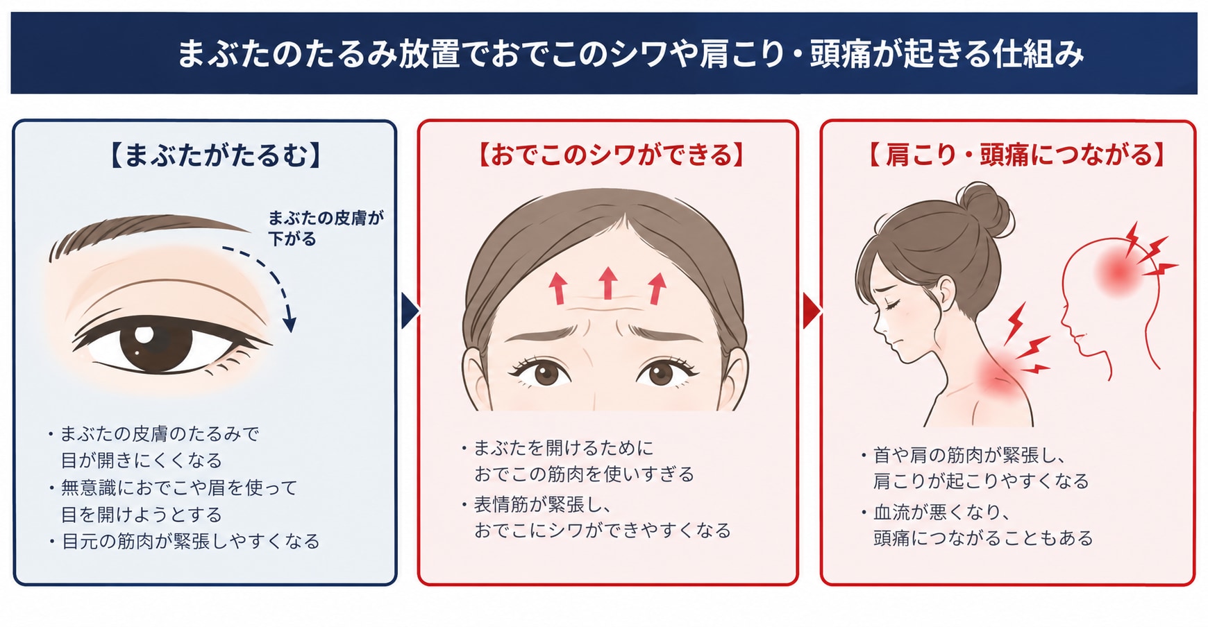 まぶたのたるみ放置でおでこのシワや肩こり・頭痛が起きる仕組み