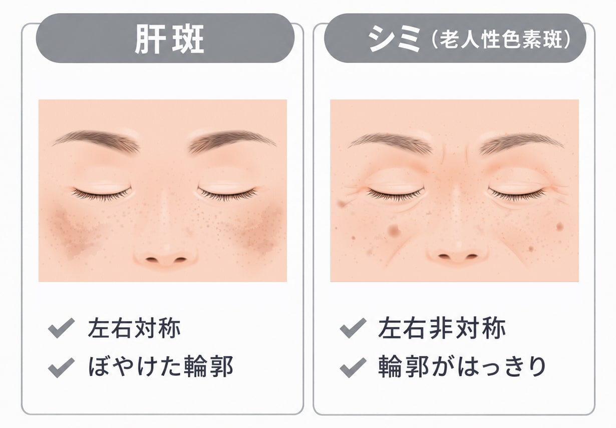 無料シミ診断】あなたのシミ・肝斑に最適な治療は？湘南美容クリニック