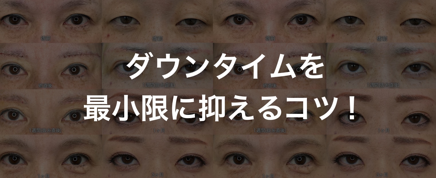 ダウンタイムを最小限に抑える5つのコツ