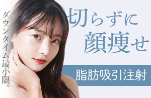 ダウンタイム、最小限。