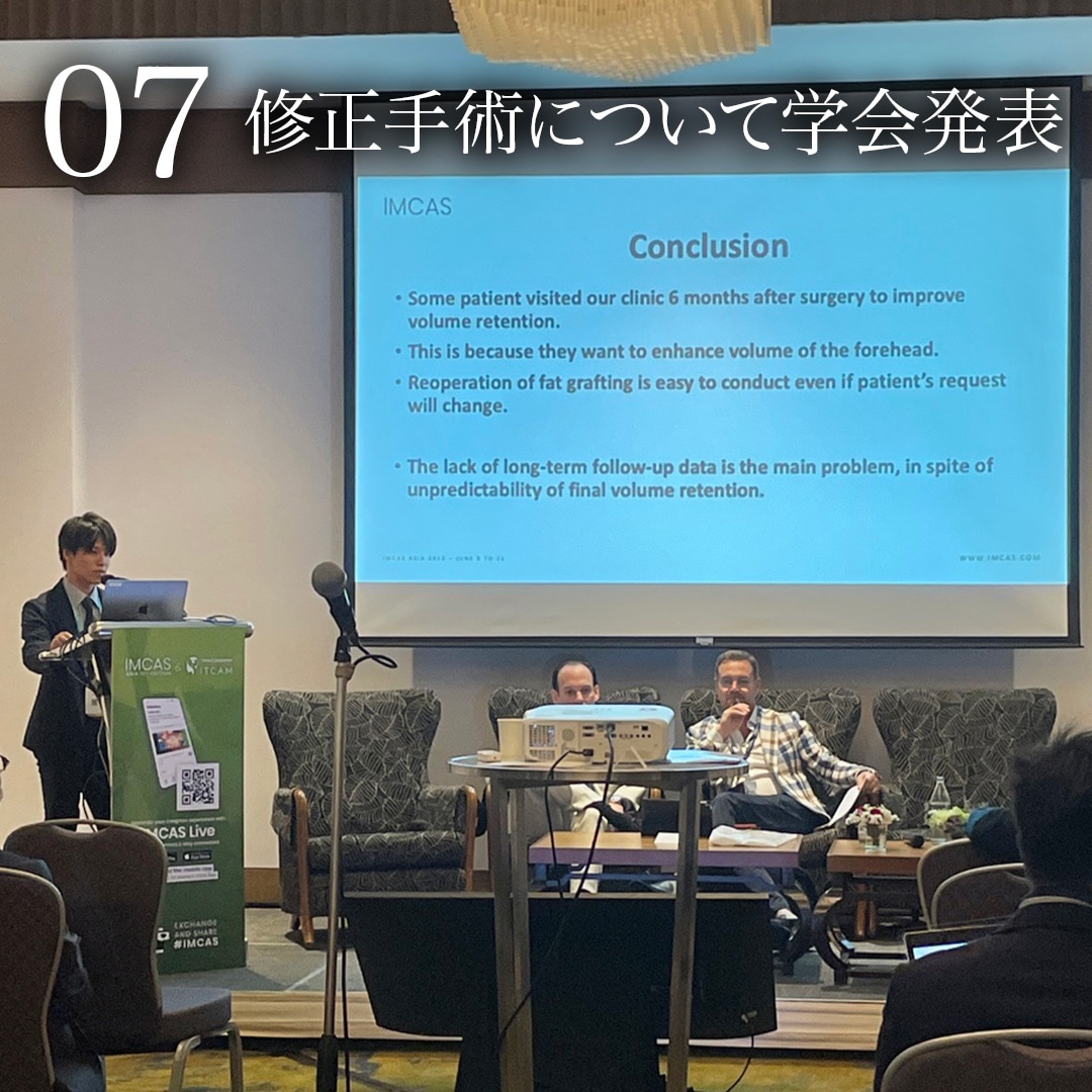 頬は痩けるのになぜ脂肪吸引?脂肪吸引執刀数日本一を誇る美容外科医が「正しい施術」のポイントを詳しく解説 - 秋葉原院