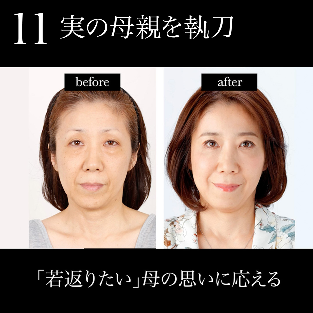 11.実の母親を執刀