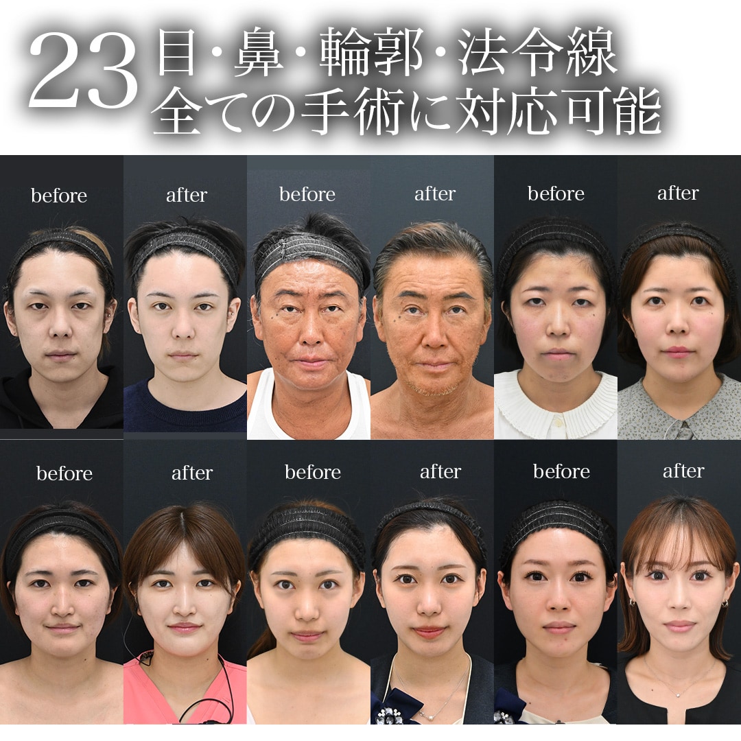 23.目・鼻・輪郭・法令線 全ての手術に対応可能