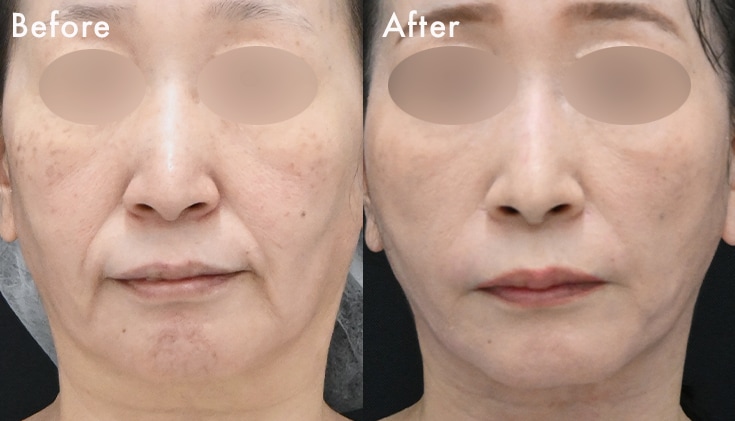 50代・女性