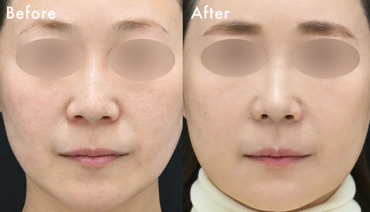 40代・女性