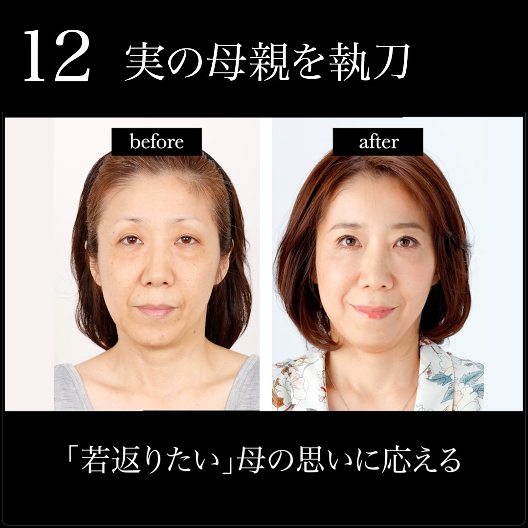 12.実の母を執刀