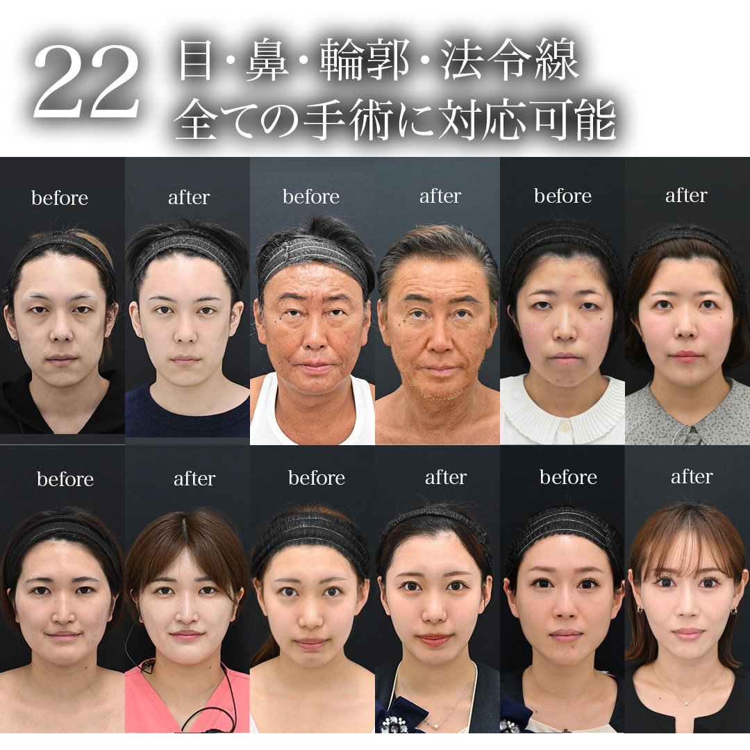 22.目・鼻・輪郭・法令線、全ての手術に対応可能<br />