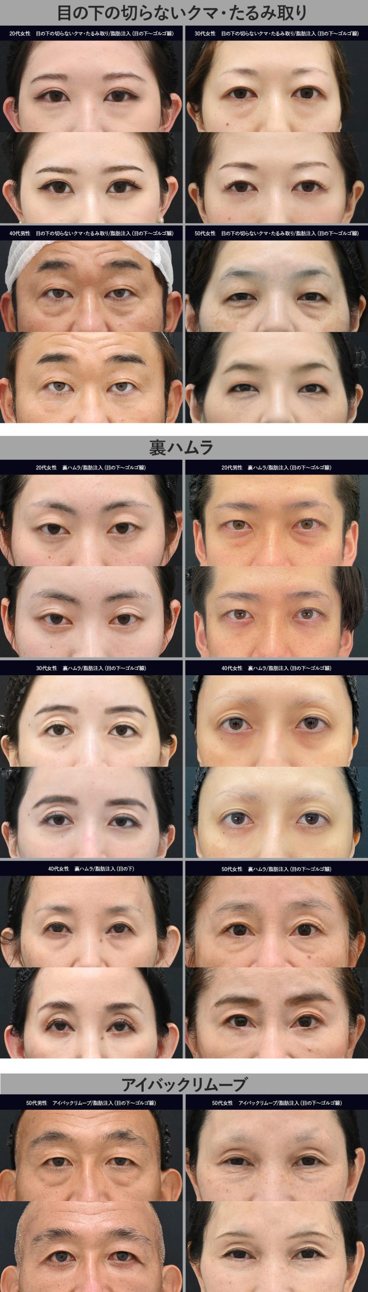 成功症例写真集｜ビフォーアフターで見る改善効果