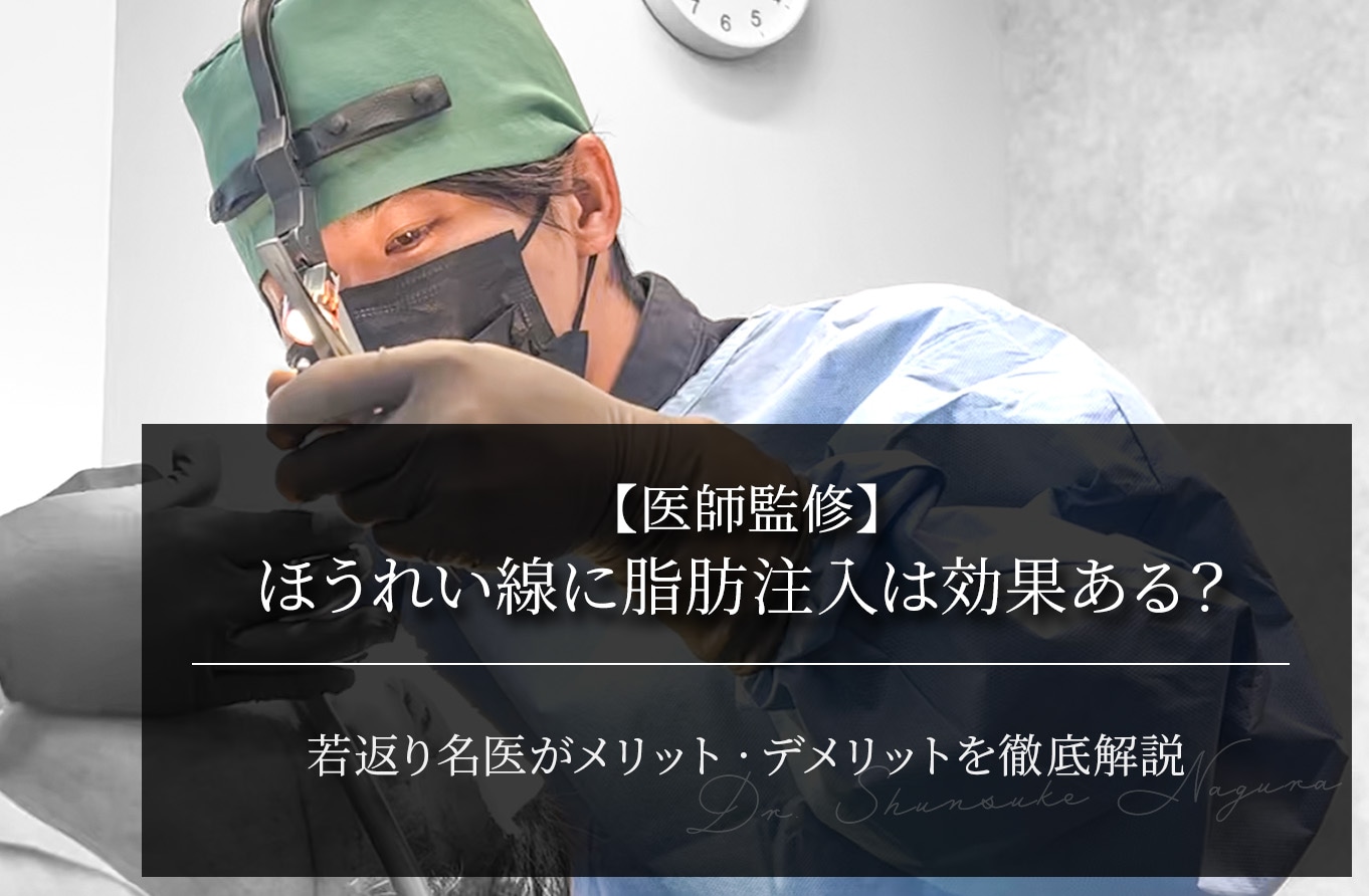 【医師監修】ほうれい線に脂肪注入は効果ある？メリット・デメリットや向いている人を解説