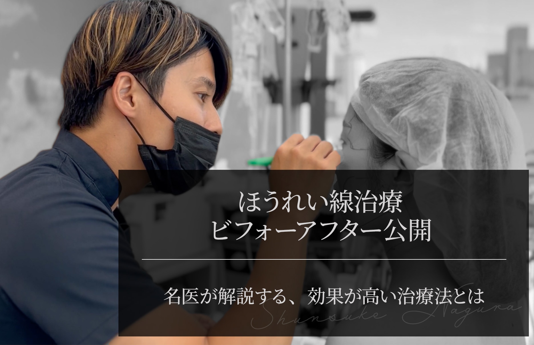 ほうれい線整形のビフォーアフター公開｜効果が高い治療法とは？