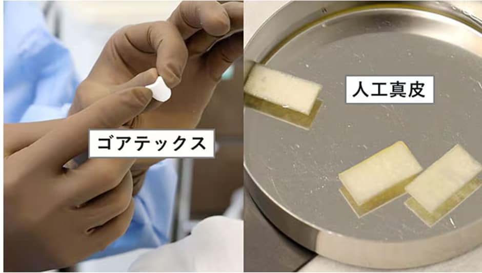 人工真皮・ゴアテックス挿入