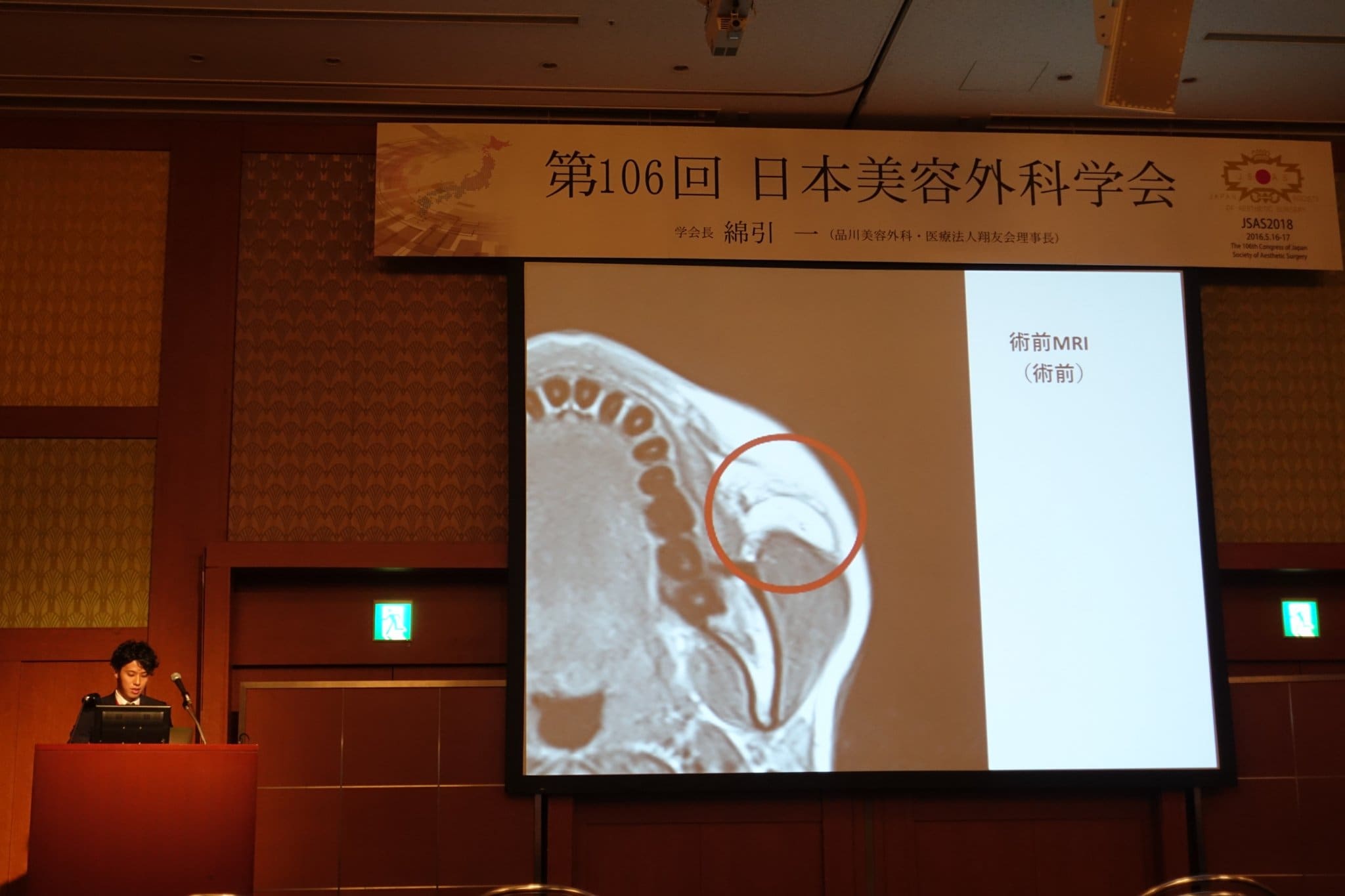 1,200例超の症例を国際学会で報告
