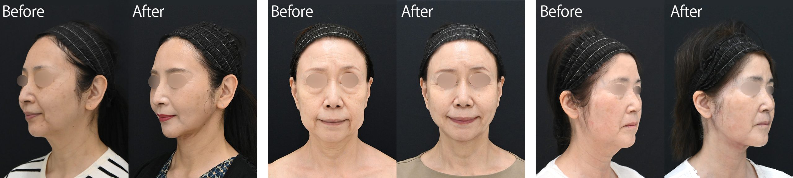 60代