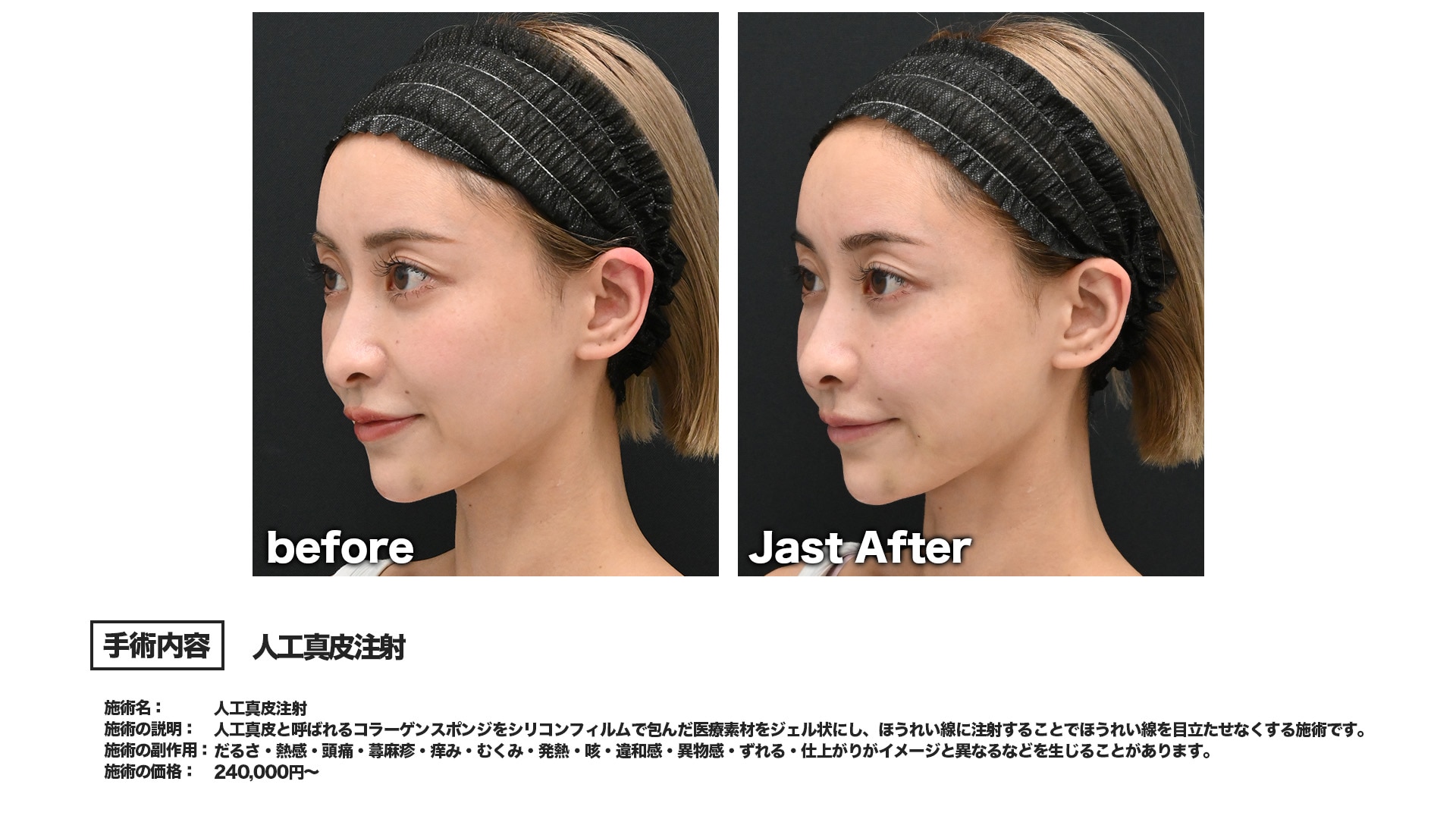 無理なく若返りたい方にフィットする治療選択