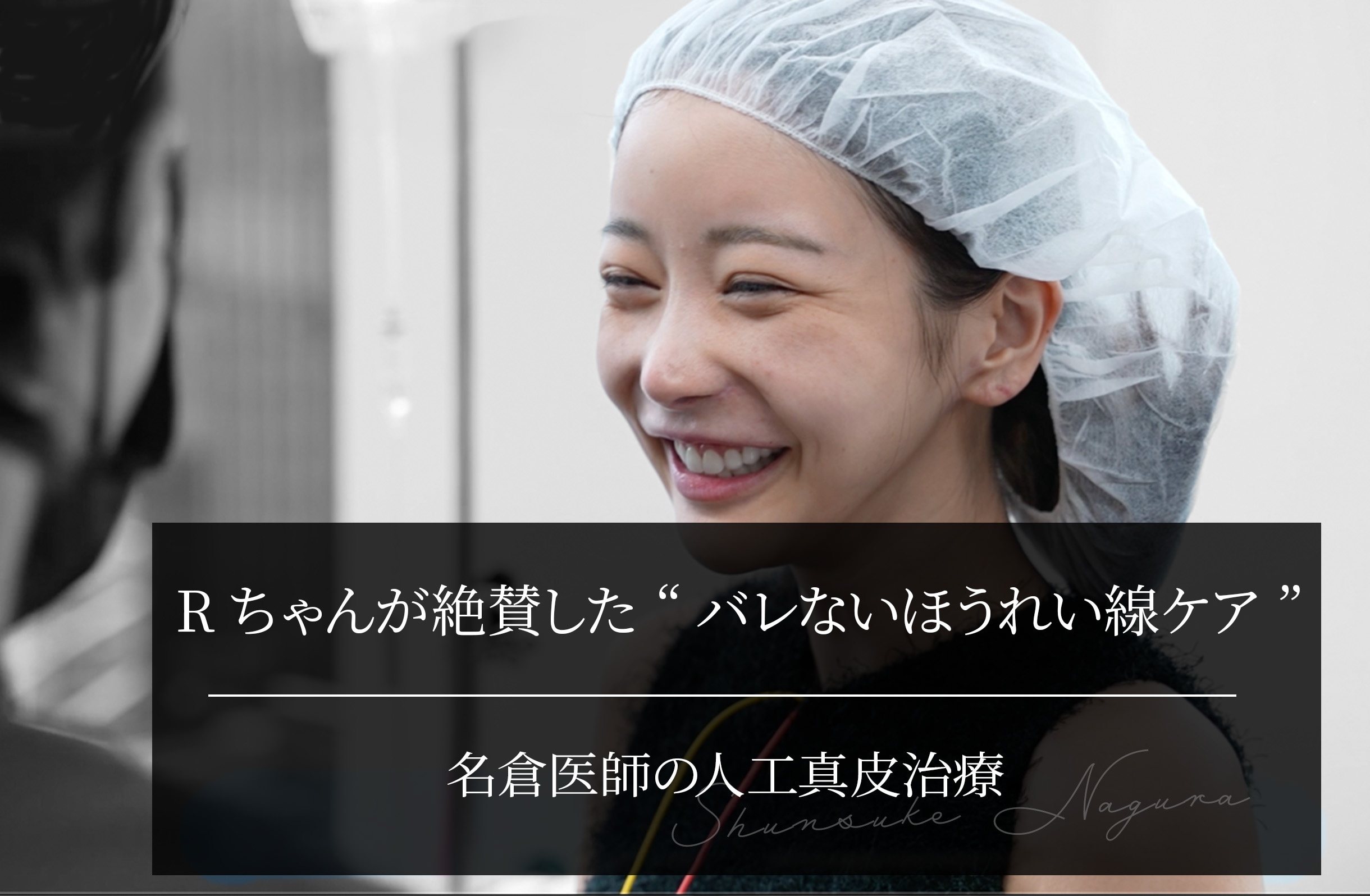 Rちゃんが絶賛した“バレないほうれい線ケア”｜名倉医師の人工真皮治療