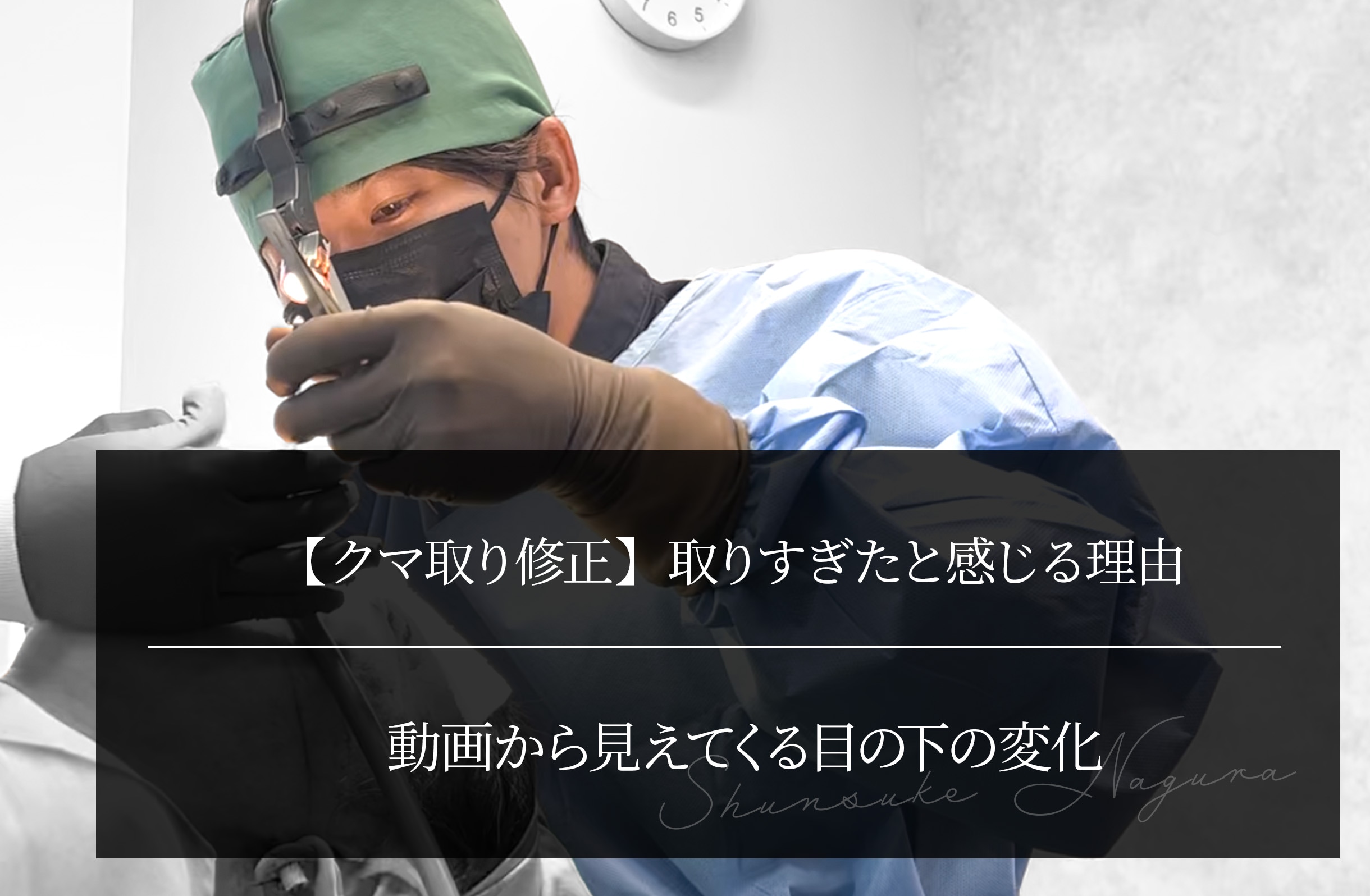 【クマ取り修正】取りすぎたと感じる理由 ｜動画から見えてくる目の下の変化