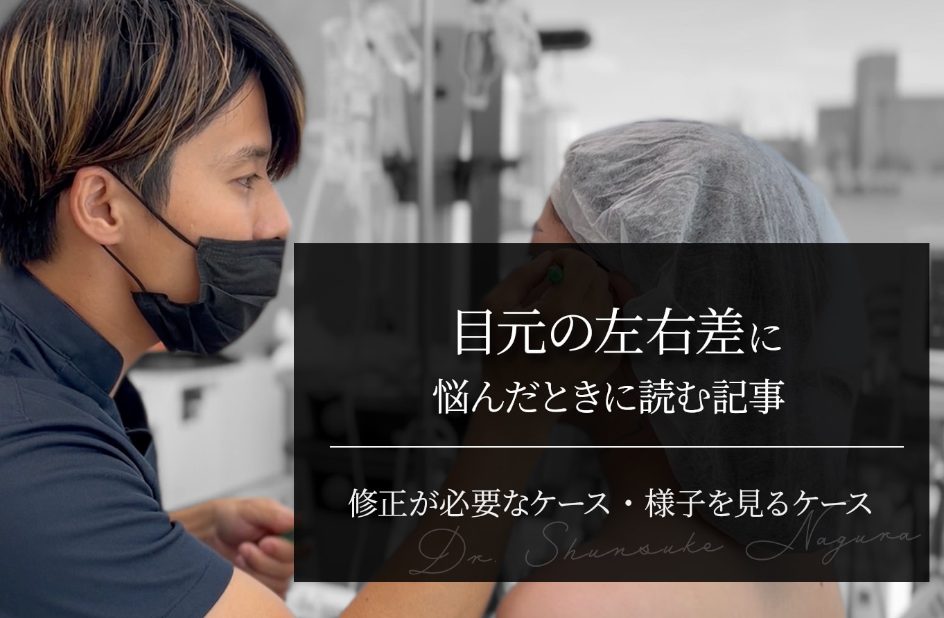 目元の左右差に悩んだときに読む記事｜修正が必要なケース・様子を見るケース