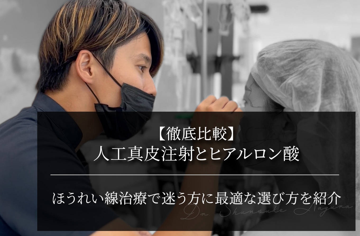 【徹底比較】人工真皮注射とヒアルロン酸 ほうれい線治療で迷う方に最適な選び方を紹介