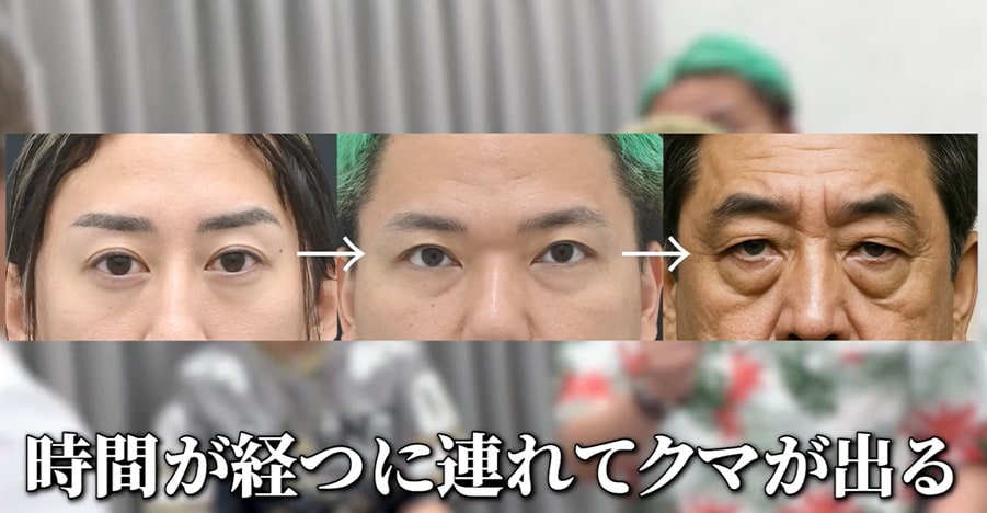 男性のクマ取りは“女性より難しい”