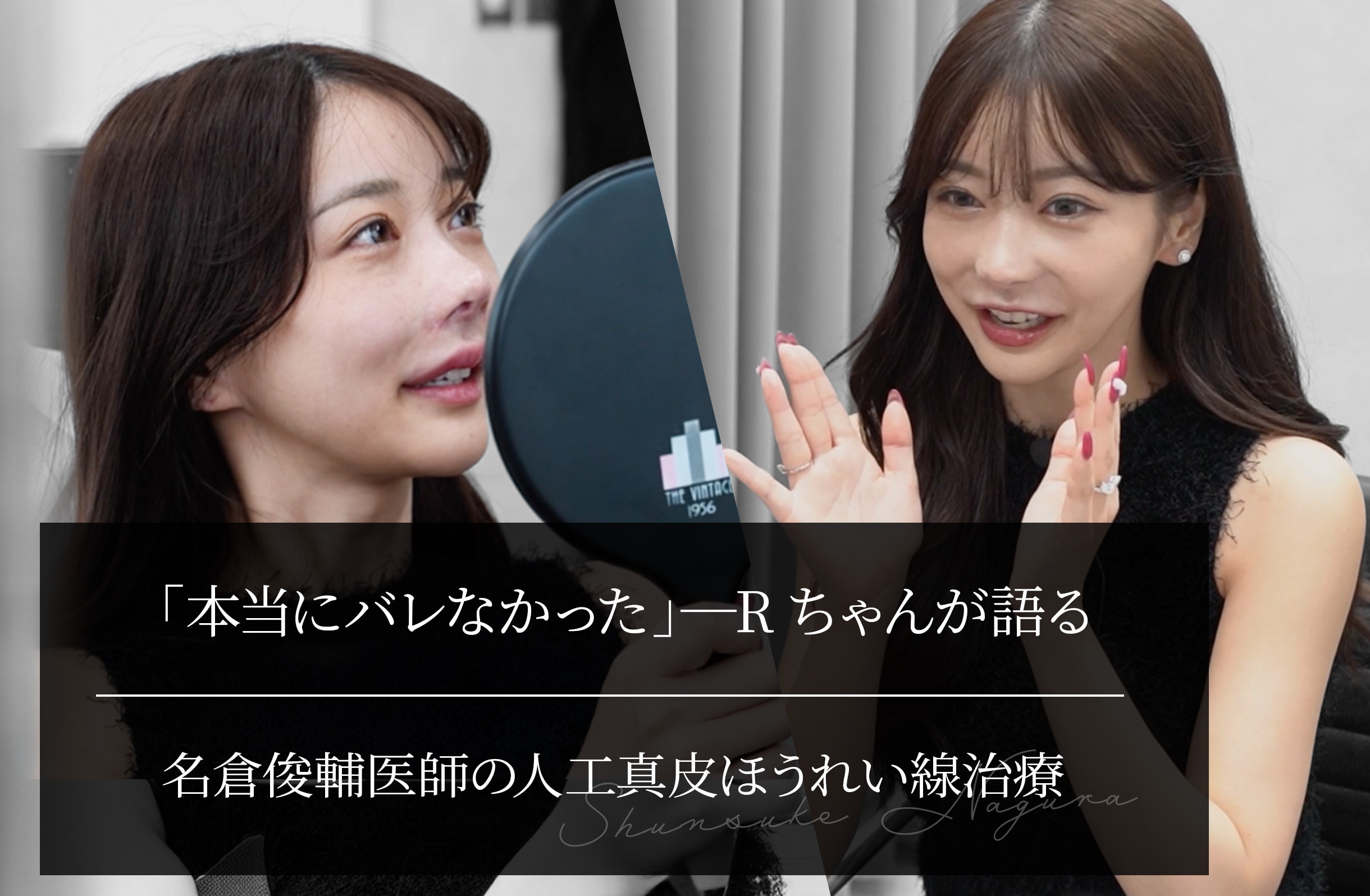 「本当にバレなかった」──Rちゃんが語る、名倉俊輔医師の人工真皮ほうれい線治療