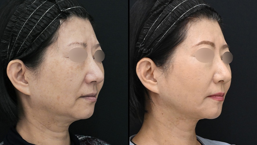 「何しても治らない」と感じやすい典型パターン