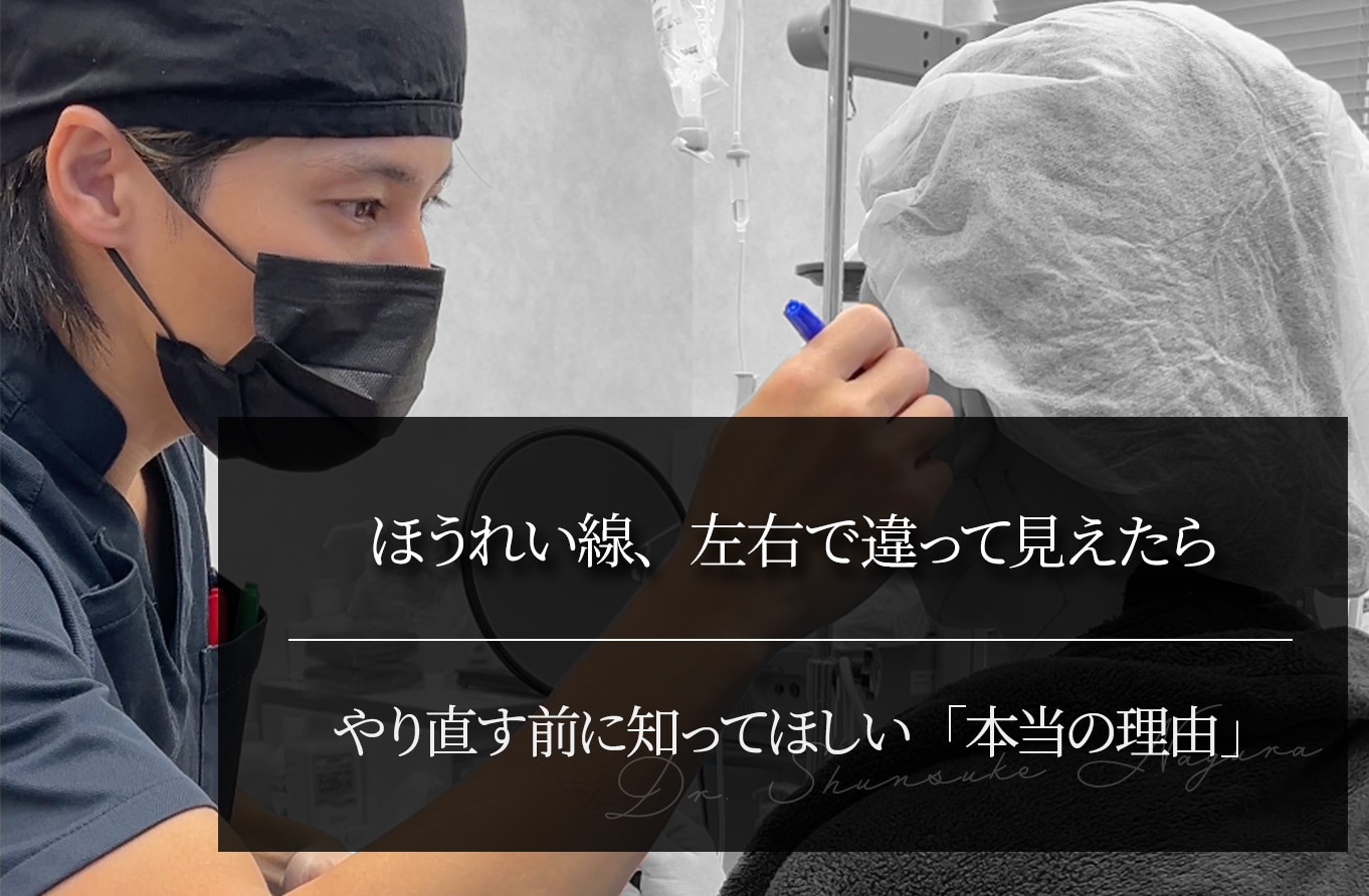 ほうれい線、左右で違って見えたら ｜やり直す前に知ってほしい「本当の理由」