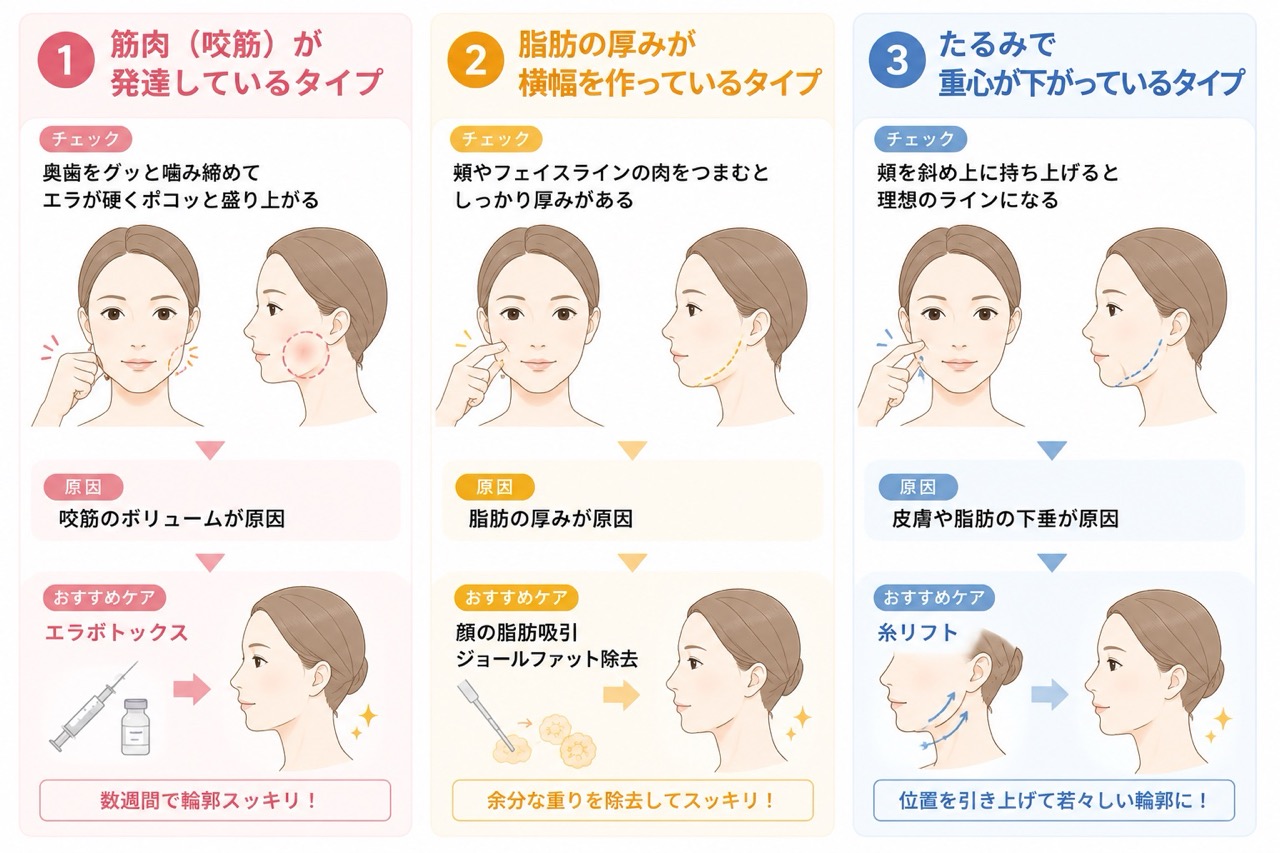 セルフチェックで分かる！筋肉・脂肪・重力のどれが主因？<br />
