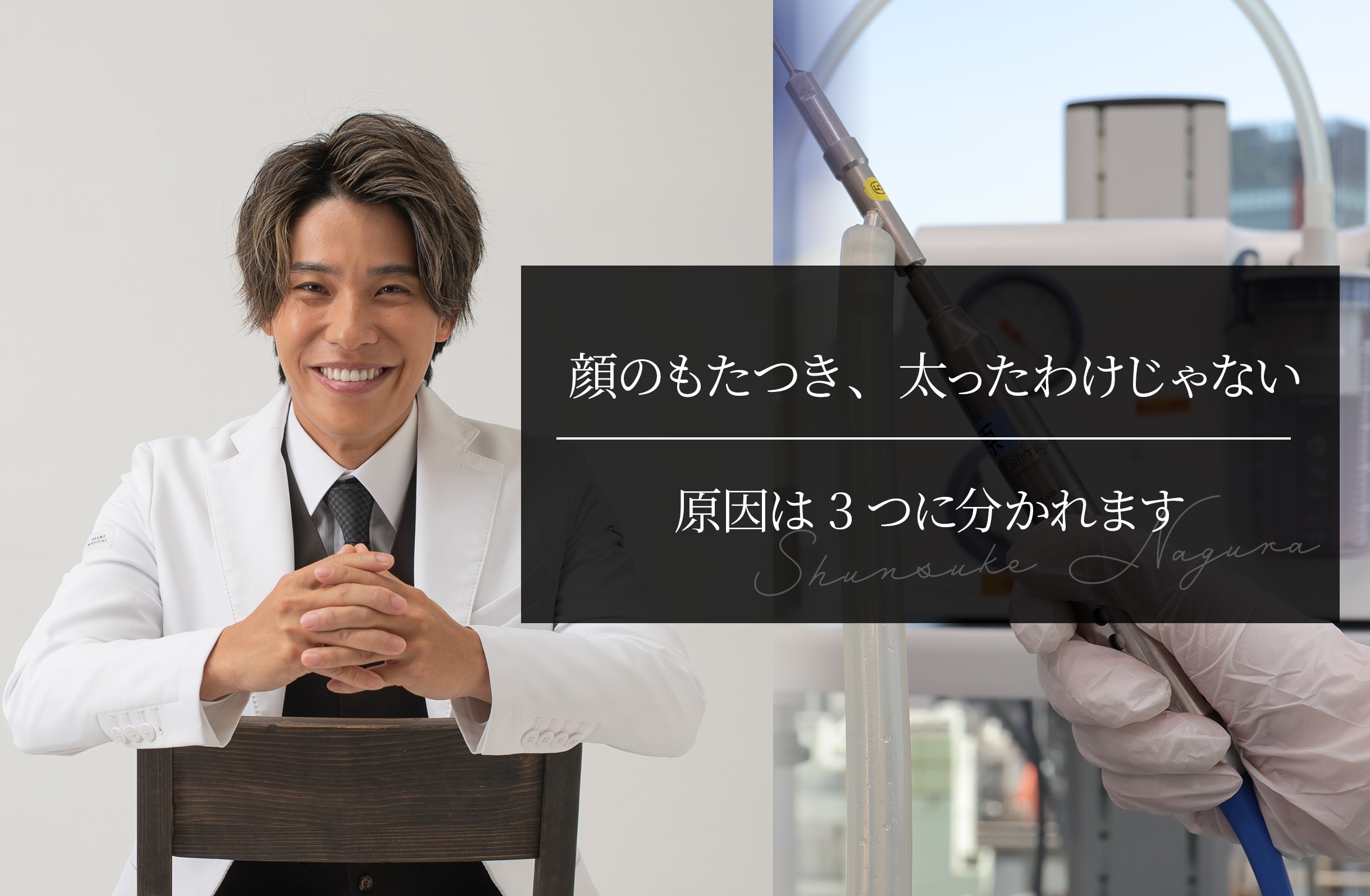 顔のもたつき、太ったわけじゃない ｜原因は3つに分かれます