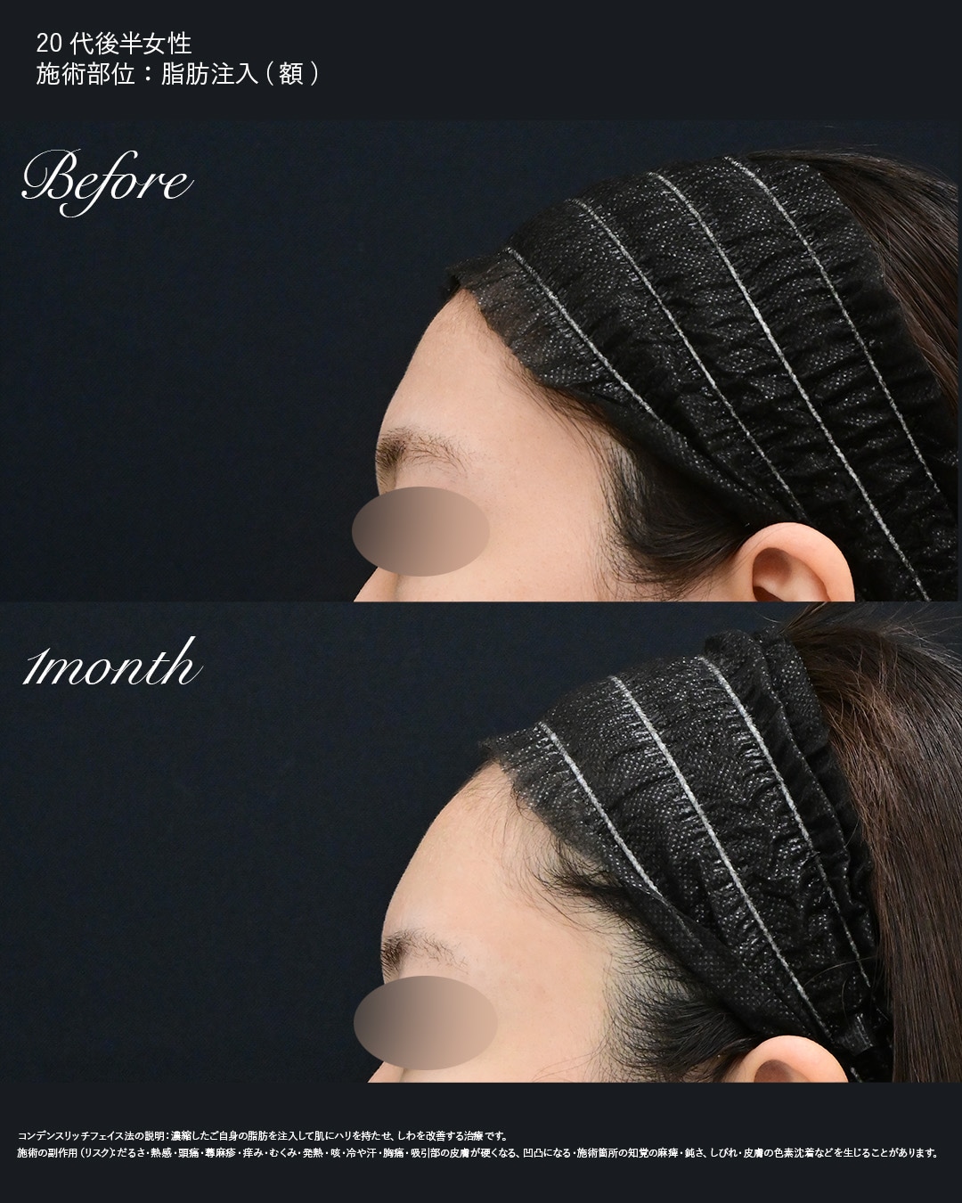 自然さとバランスを見る<br />
