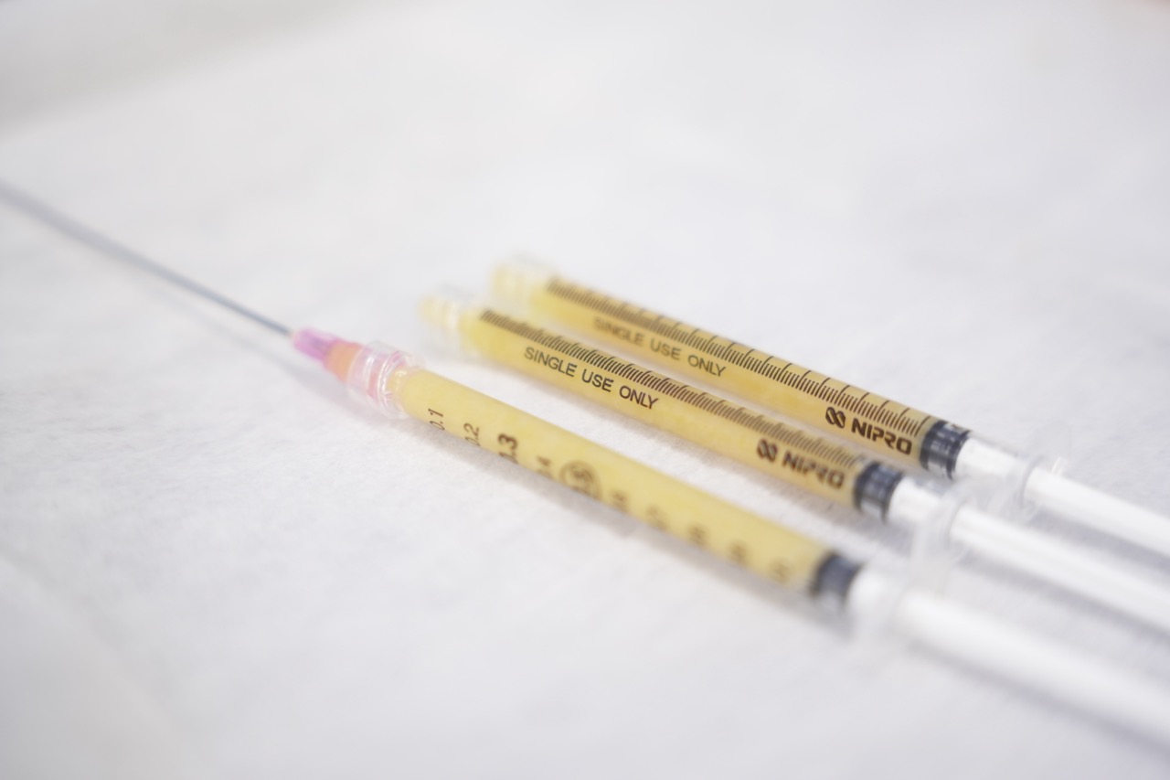 脂肪注入は“足す”だけの治療ではない