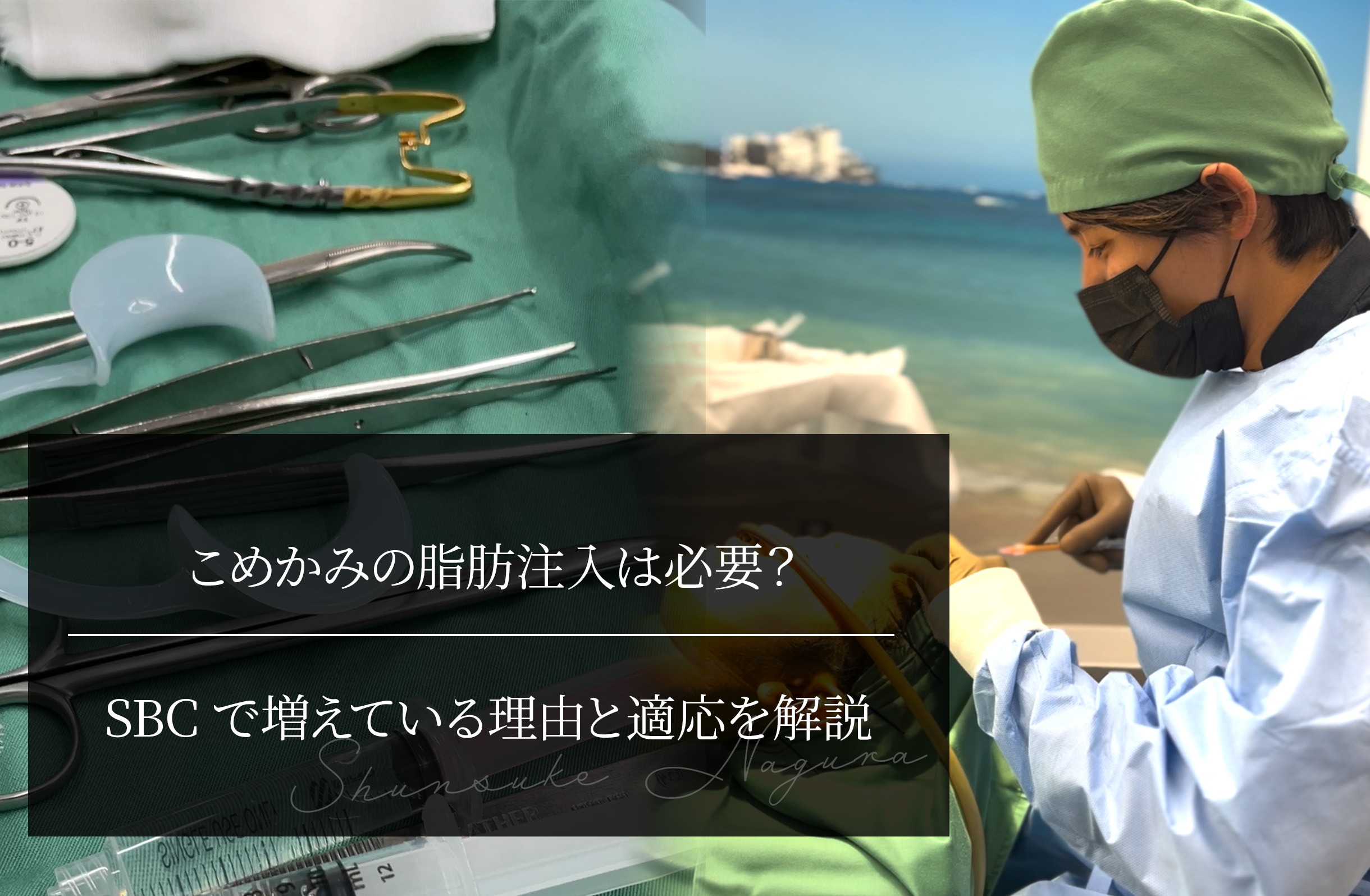 こめかみの脂肪注入は必要？ SBCで増えている理由と適応を解説