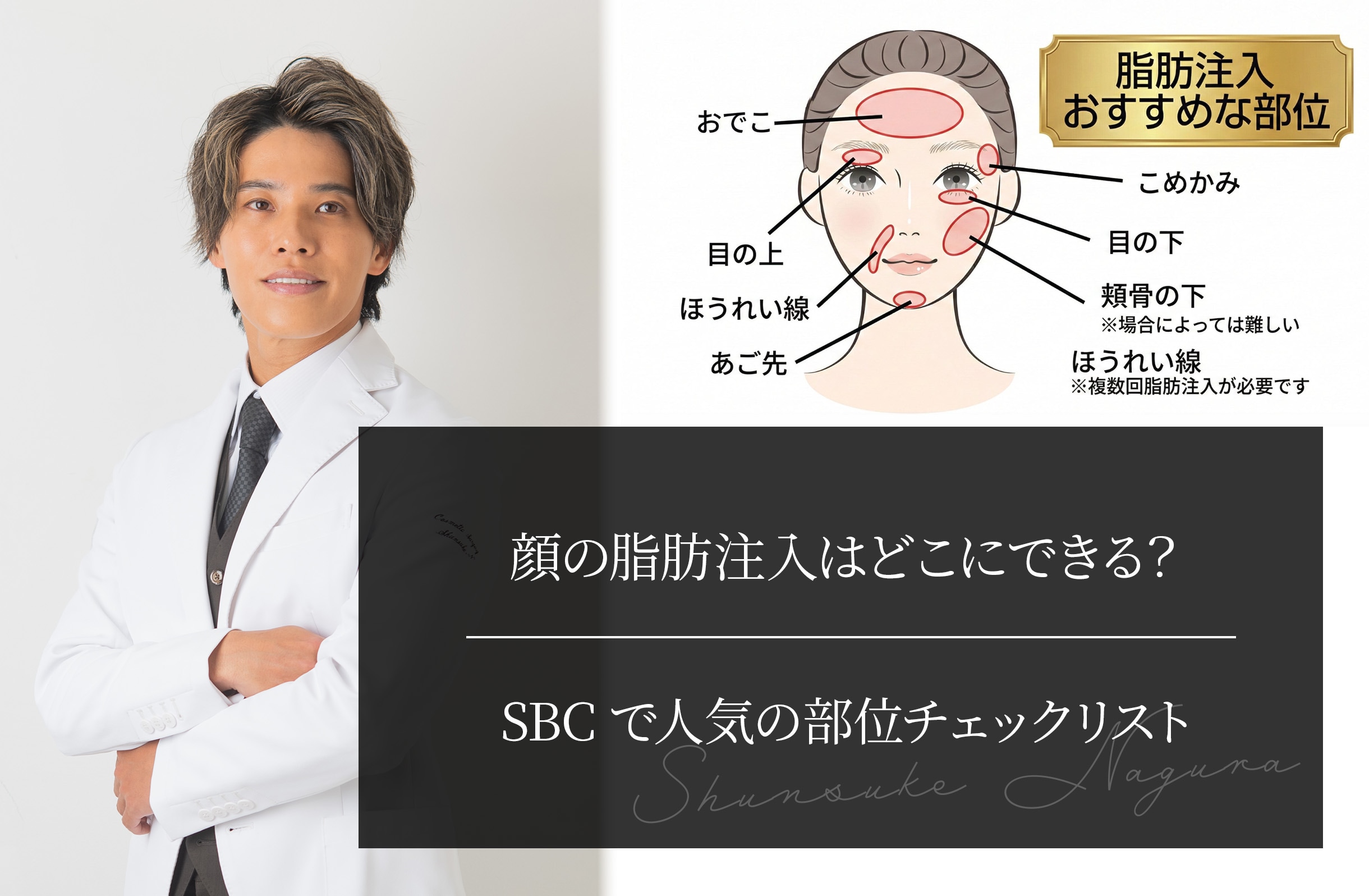 顔の脂肪注入はどこにできる？ SBCで人気の部位チェックリスト