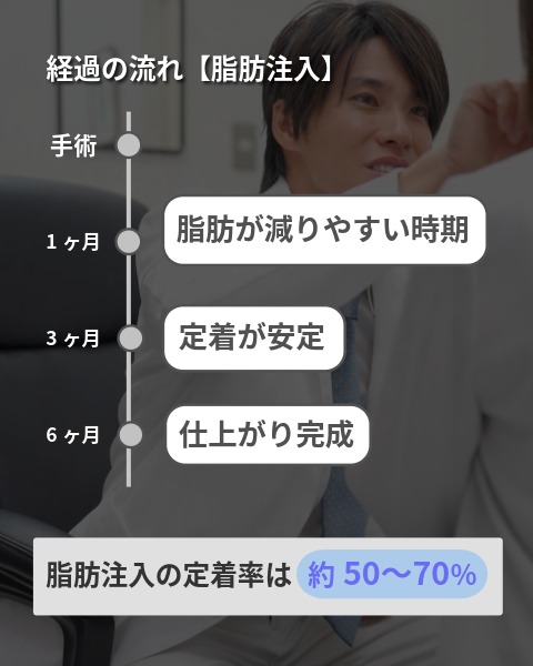 脂肪注入のダウンタイム<br />
