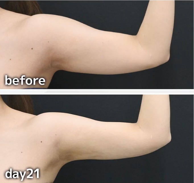 医師が教える「一時的な拘縮」と「技術不足」の決定的な違い<br />
