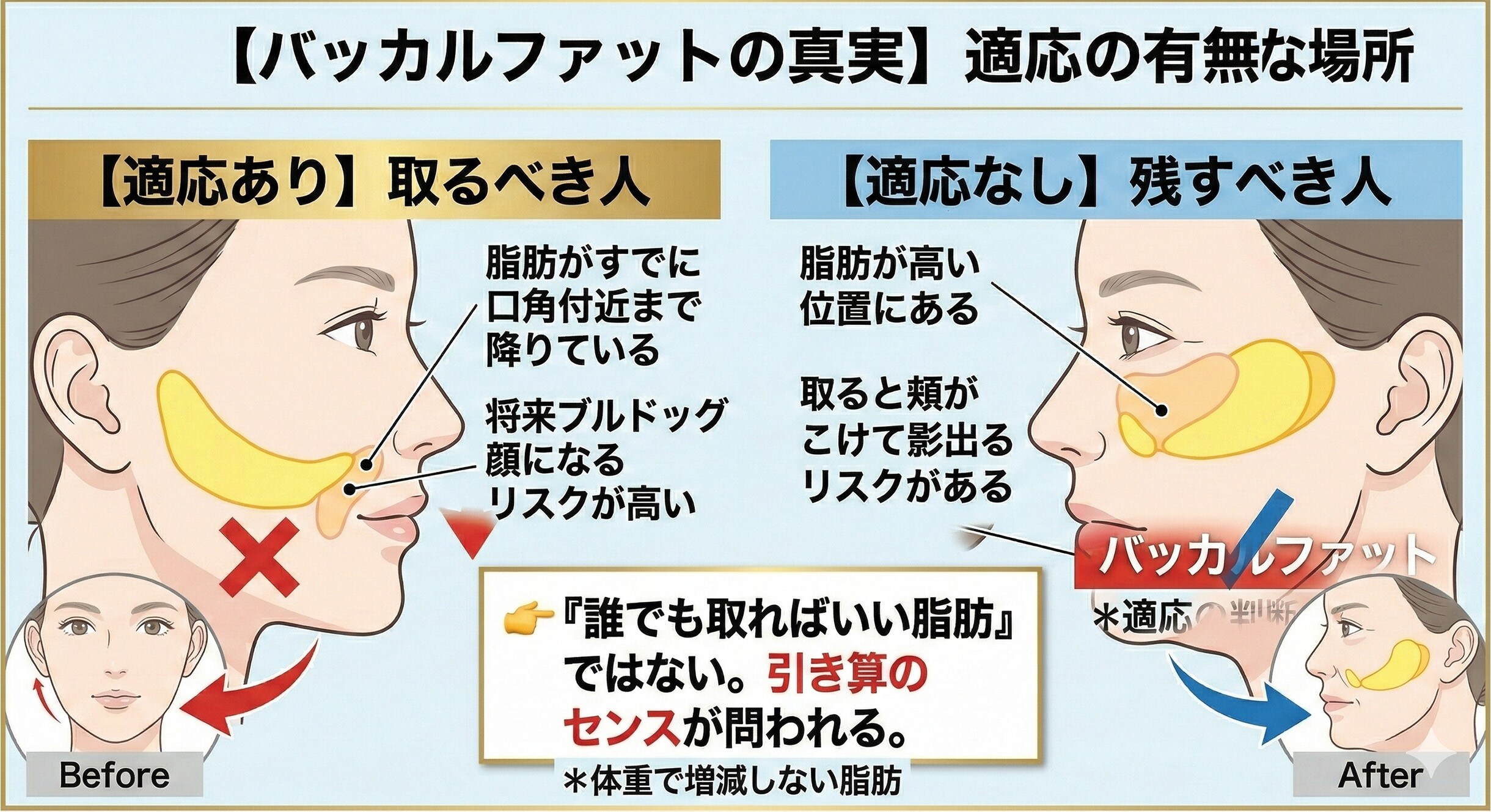 バッカルファットは全員が取るべきではない