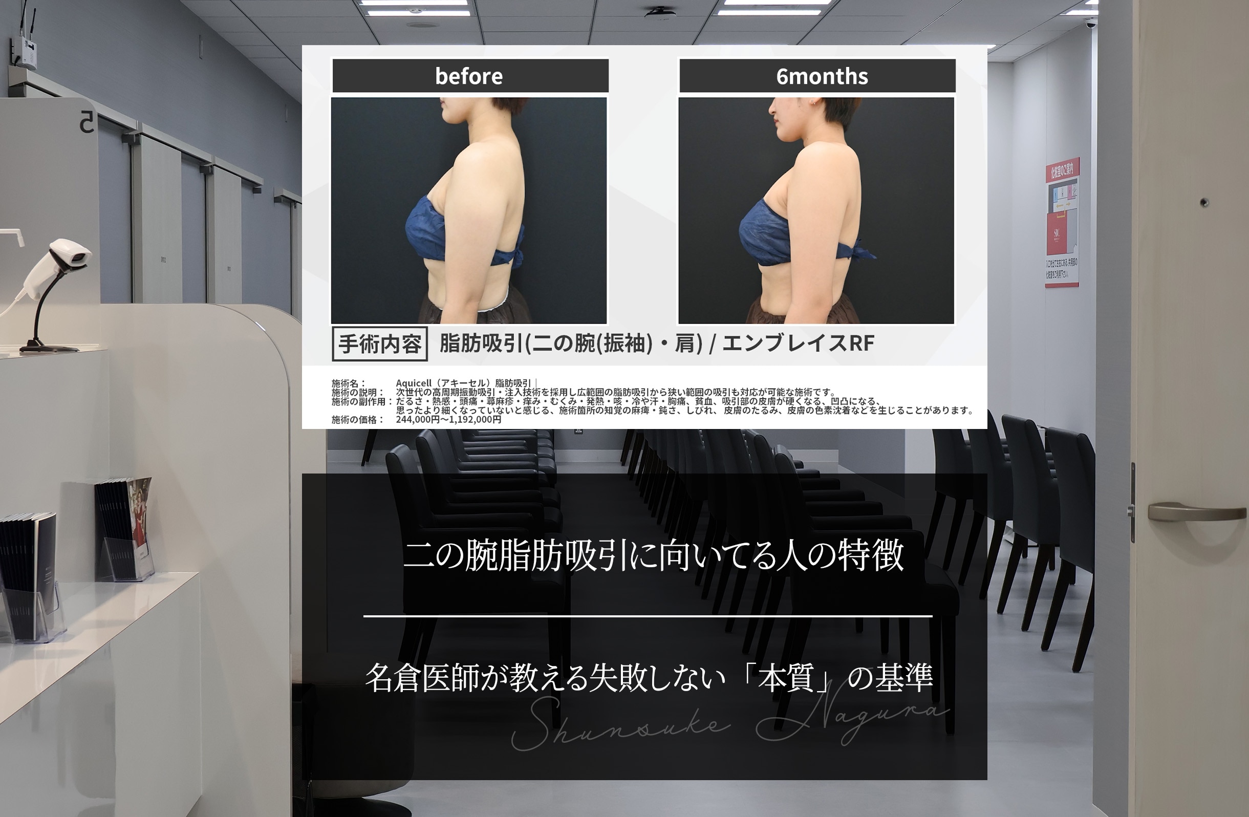 二の腕脂肪吸引に向いてる人の特徴｜名倉医師が教える失敗しない「本質」の基準