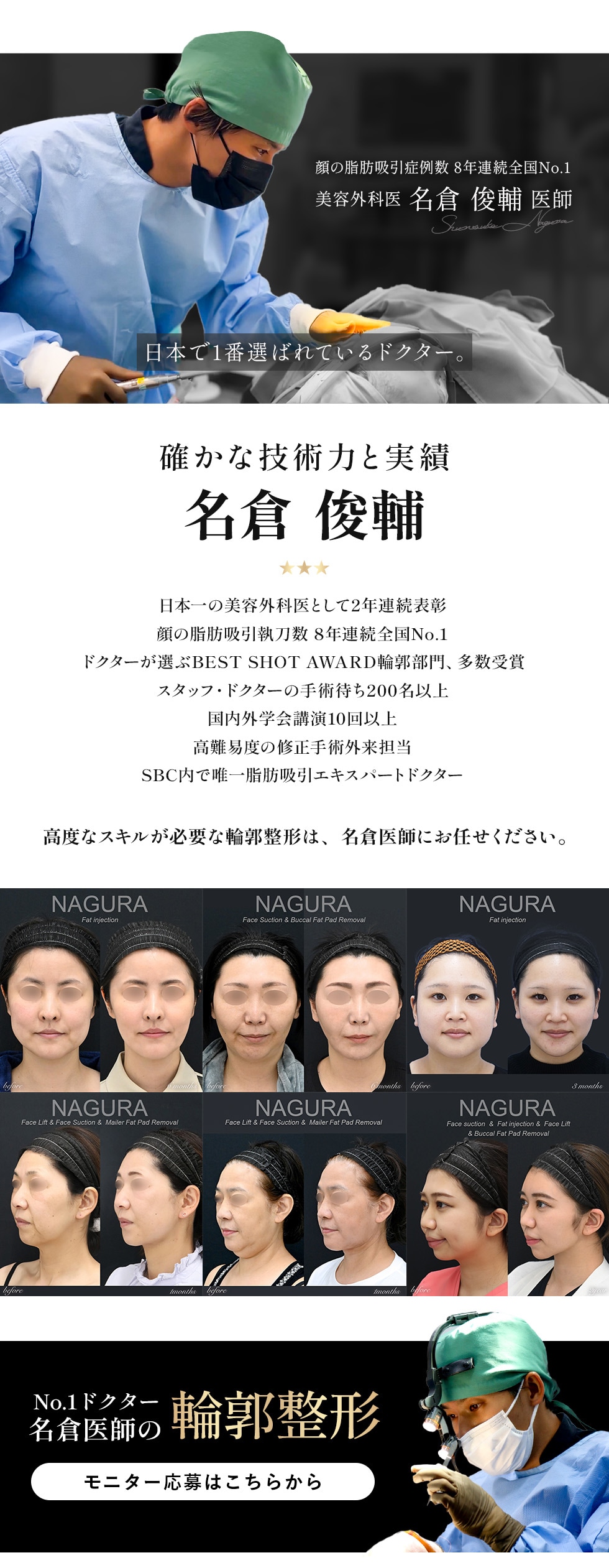 「なりたい」が、かなう。症例数全国No.1ドクターの輪郭形成術