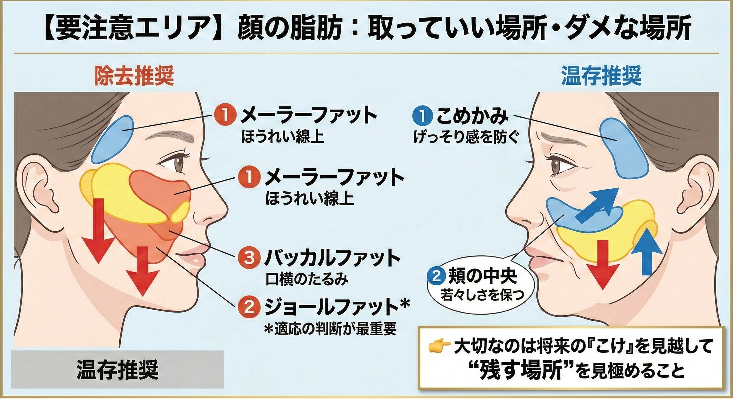 顔の脂肪は「場所」で全く意味が変わる