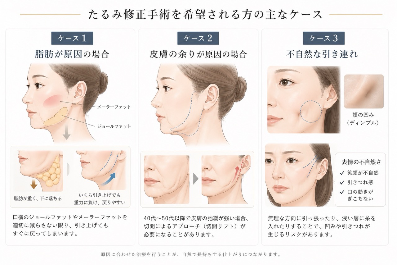 あなたに必要なのは引き上げ？それとも減量？