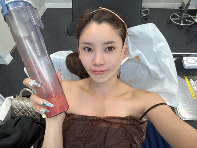③ 麻酔でぐっすり！眠っている間に完了する無傷オペ<br />
