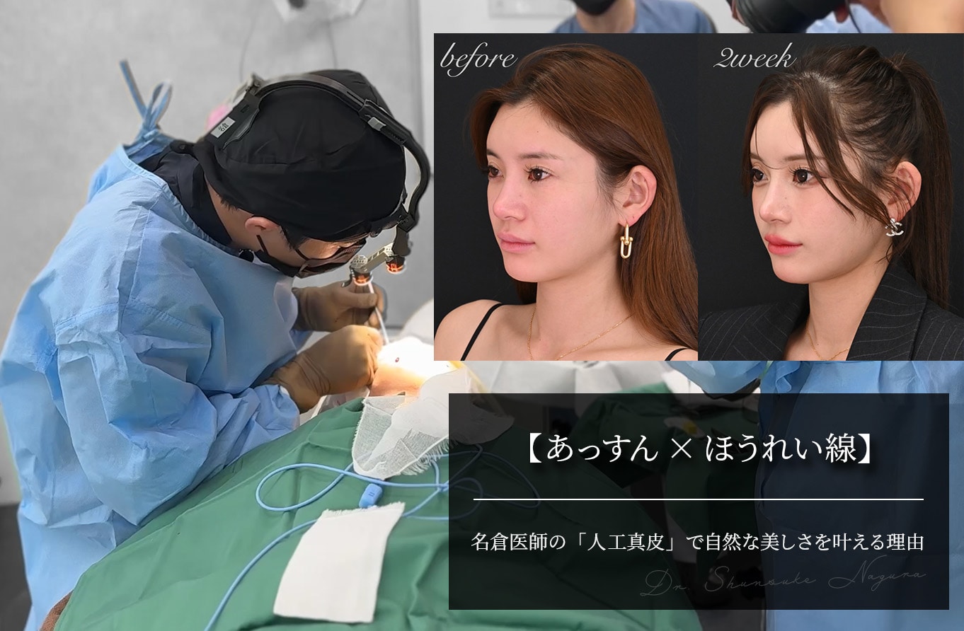 【あっすん×ほうれい線】名倉医師の「人工真皮」で自然な美しさを叶える理由