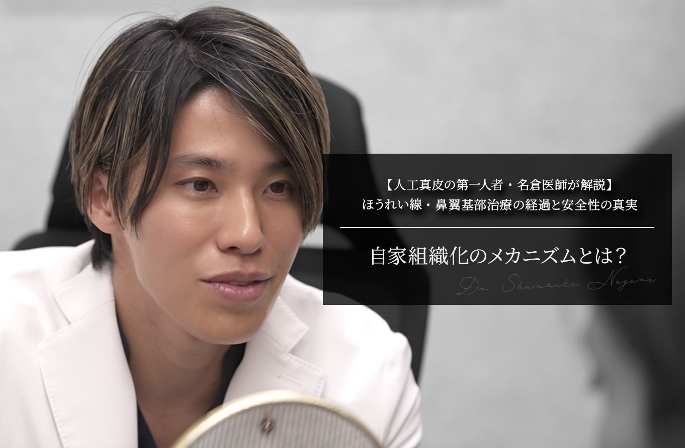 【人工真皮の第一人者・名倉医師が解説】ほうれい線・鼻翼基部治療の経過と安全性の真実｜自家組織化のメカニズムとは？