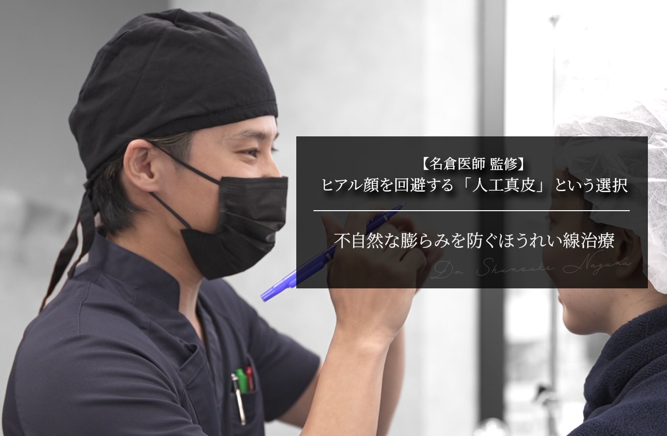 【名倉医師 監修】ヒアル顔を回避する「人工真皮」という選択｜不自然な膨らみを防ぐほうれい線治療