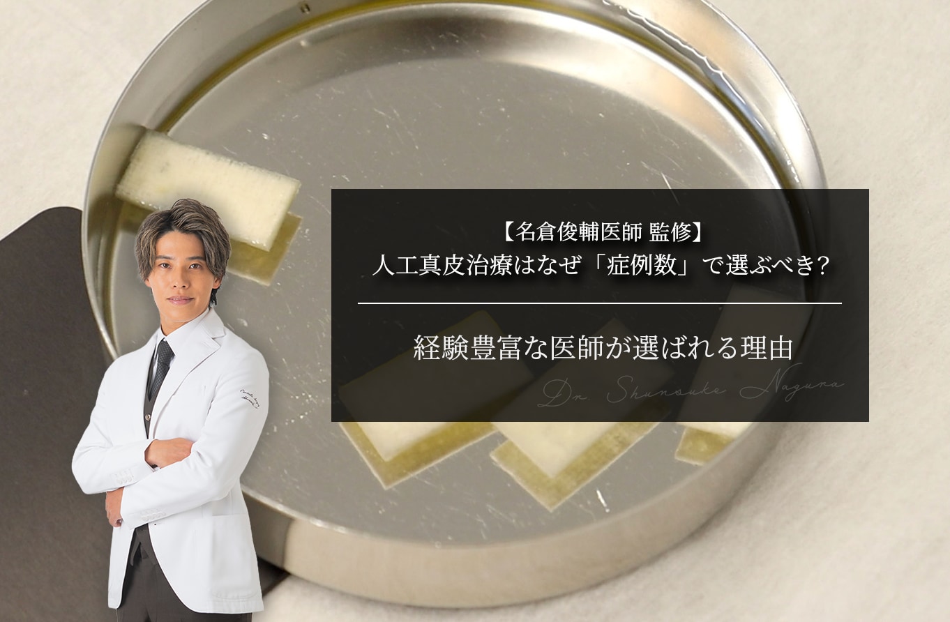 【名倉俊輔医師 監修】人工真皮治療はなぜ「症例数」で選ぶべき？経験豊富な医師が選ばれる理由