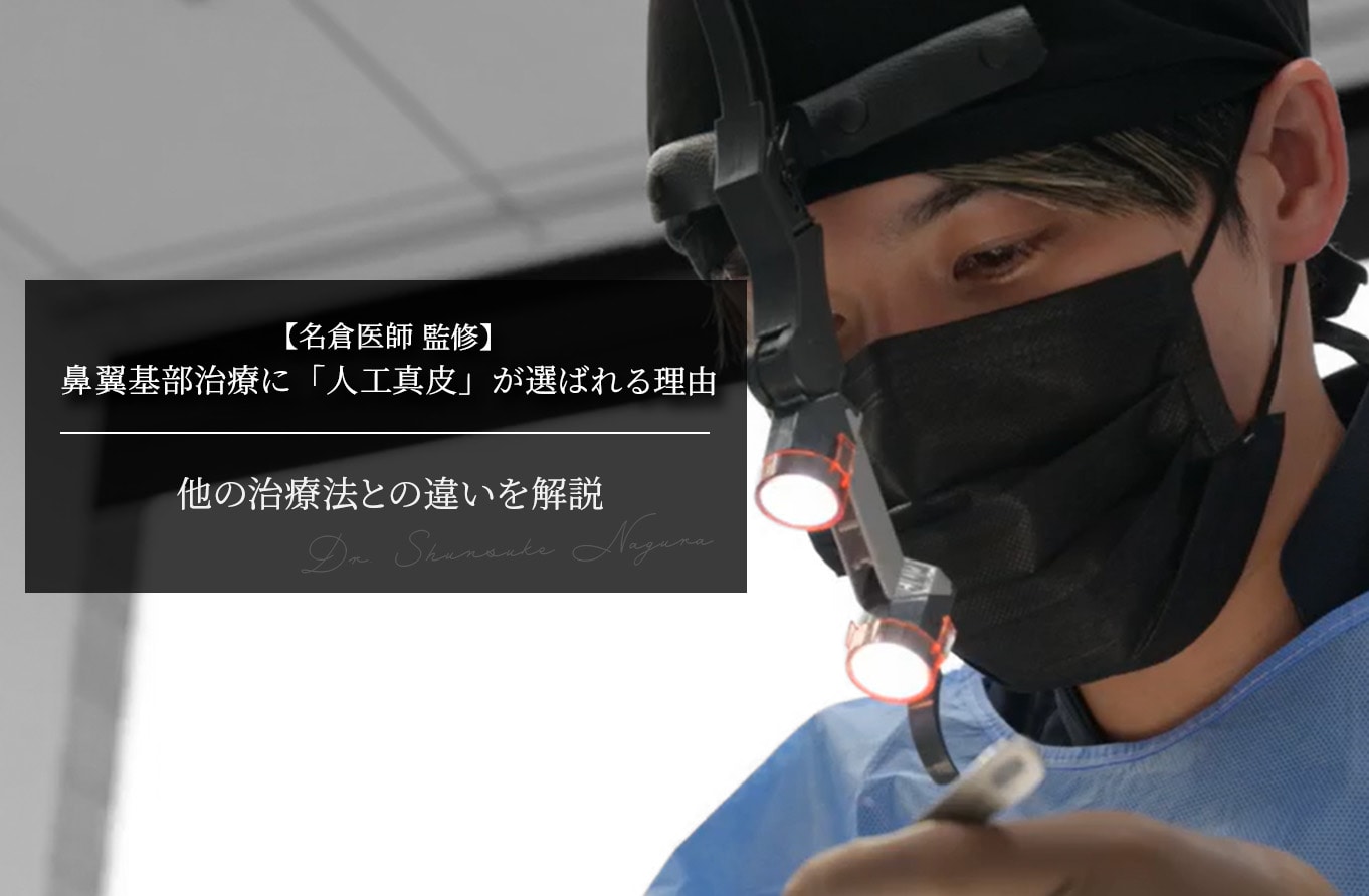 鼻翼基部治療に「人工真皮」が選ばれる理由｜他の治療法との違いを解説